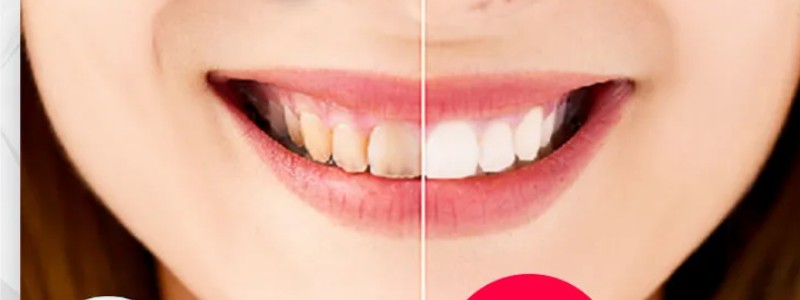 薬用ホワイトニング歯磨きジェル【e-white】情報サイト